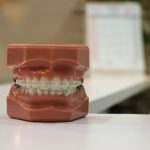 Bevar dine tænder sunde med jævnlige tandlæge besøg