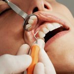 Få akut tandlægehjælp hos din tandlæge i Søborg