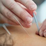 Bliv behandlet med akupunktur i Slagelse